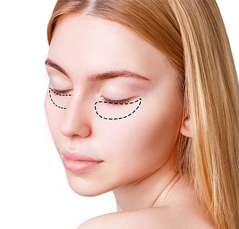 目の下のたるみ 膨らみ バギーアイを改善して若返る シンシアガーデンクリニック高崎院