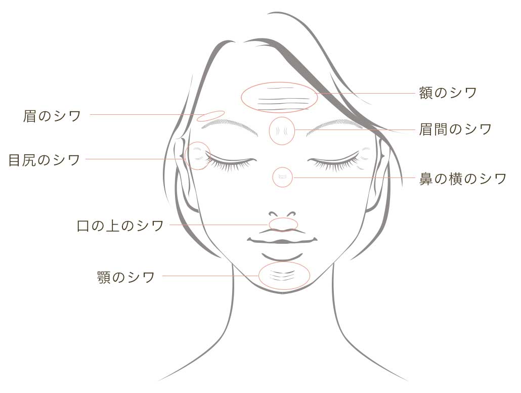 ボツリヌストキシン注射 シンシアガーデンクリニック高崎院